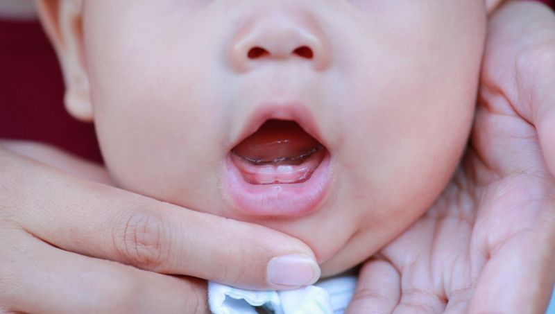 Kaip prižiūrėti vaiko dantis?