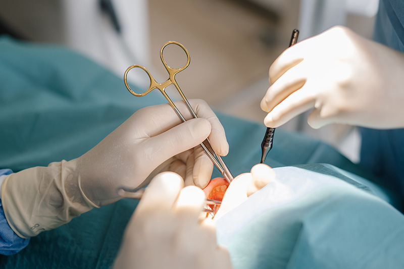 Artėjanti dantų operacija: ką reikia žinoti?